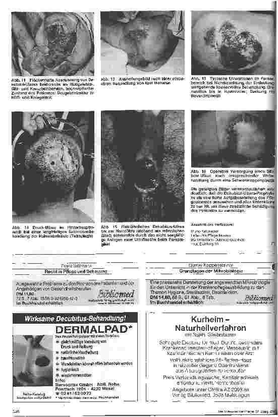 Vorschauseite 3: Der querschnittgelähmte Patient Dekubital-Ulzera-Prophylaxe