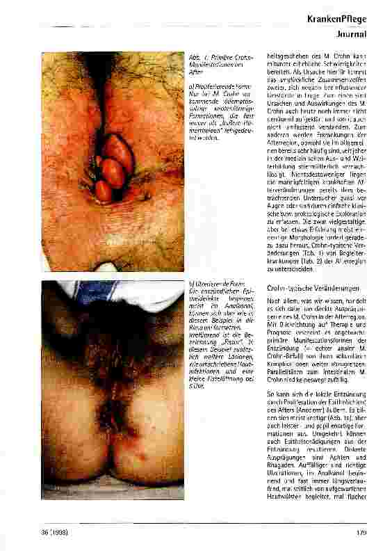 Vorschauseite 2: Anorektale und perianale Erkrankunge bei M. Crohn