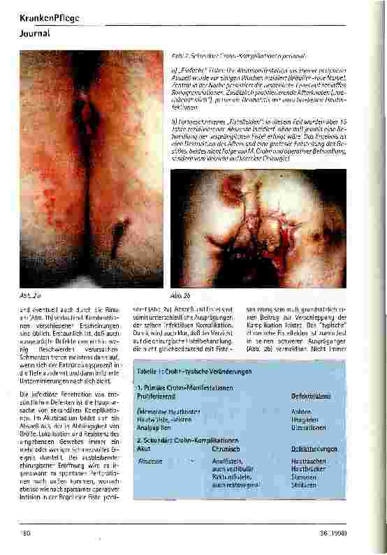 Vorschauseite 3: Anorektale und perianale Erkrankunge bei M. Crohn