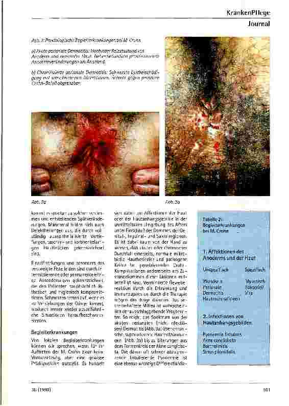 Vorschauseite 4: Anorektale und perianale Erkrankunge bei M. Crohn