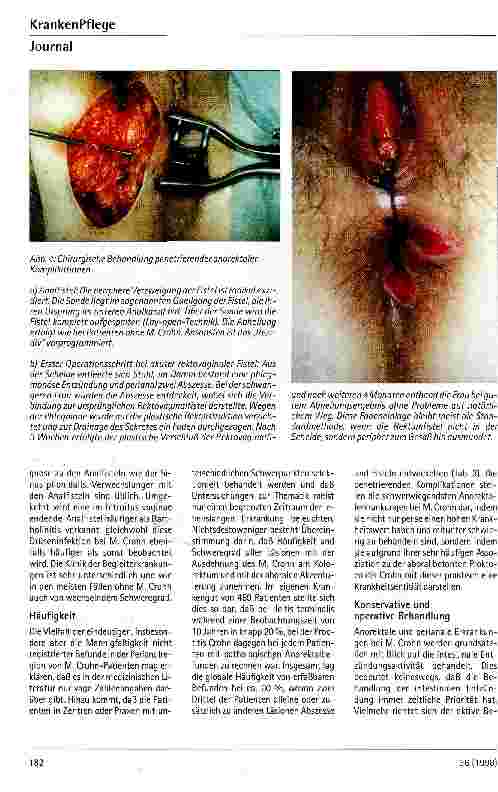 Vorschauseite 5: Anorektale und perianale Erkrankunge bei M. Crohn