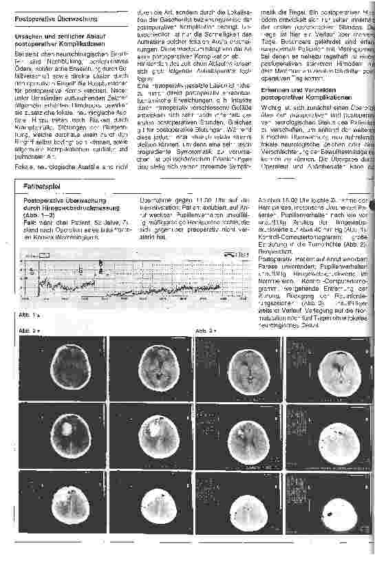 Vorschauseite 2: Postoperative Überwachung nach neurochirurgischen Wahleingriffen 1.Folge: Allgemeiner Überblick