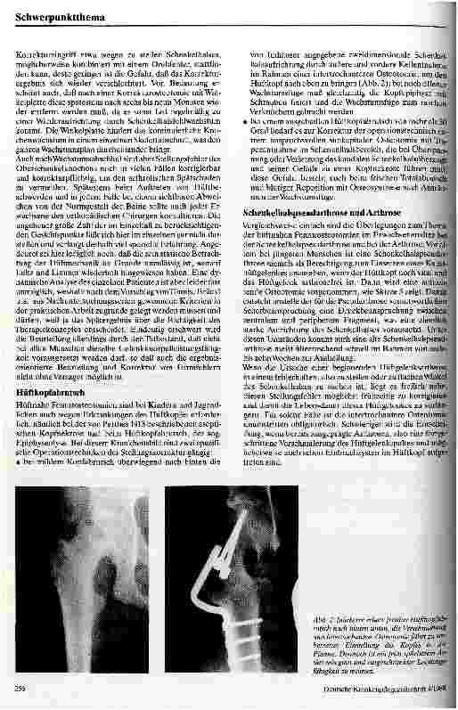 Vorschauseite 3: Hüftnahe Femurosteotomien