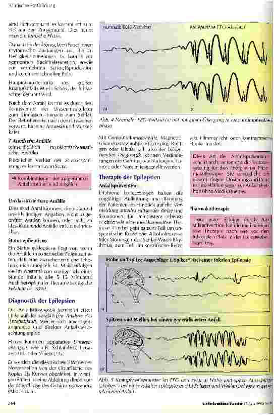Vorschauseite 3: Blitz aus heiterem Himmel? Wissenswertes über Epilepsie