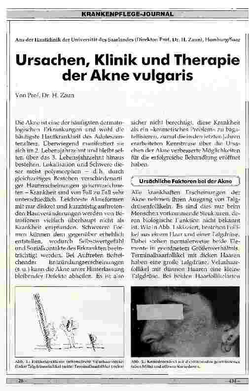 Vorschauseite 1: Ursachen, Klinik und Therapie der Akne vulgaris