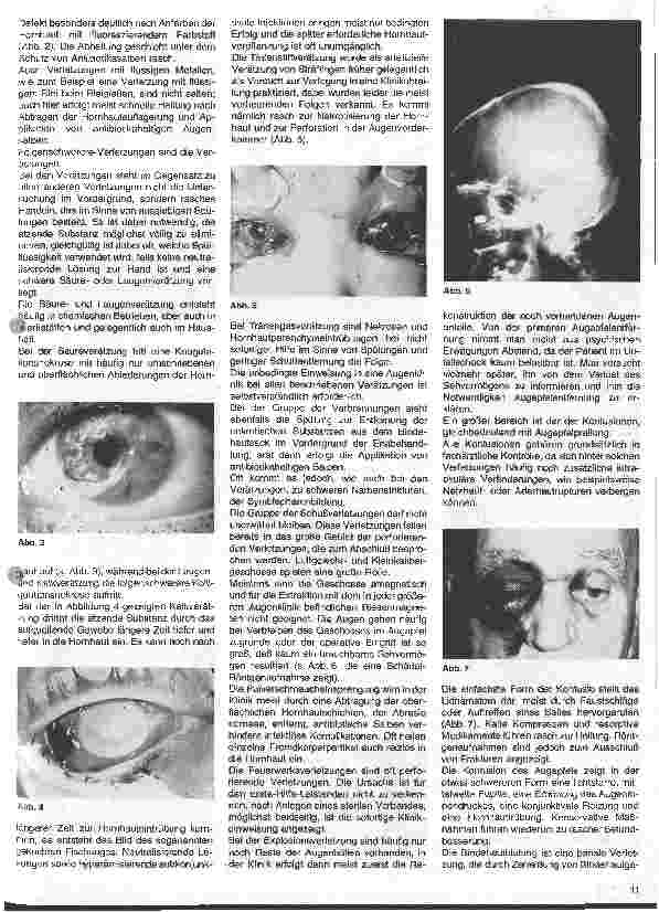 Vorschauseite 2: Notfälle bei Augenverletzungen