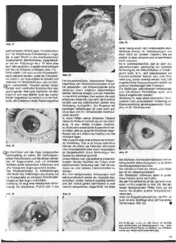 Vorschauseite 4: Notfälle bei Augenverletzungen