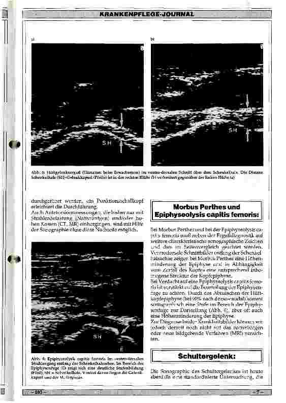 Vorschauseite 4: Welche Aufgabe hat die Sonographie in der Orthopädie?