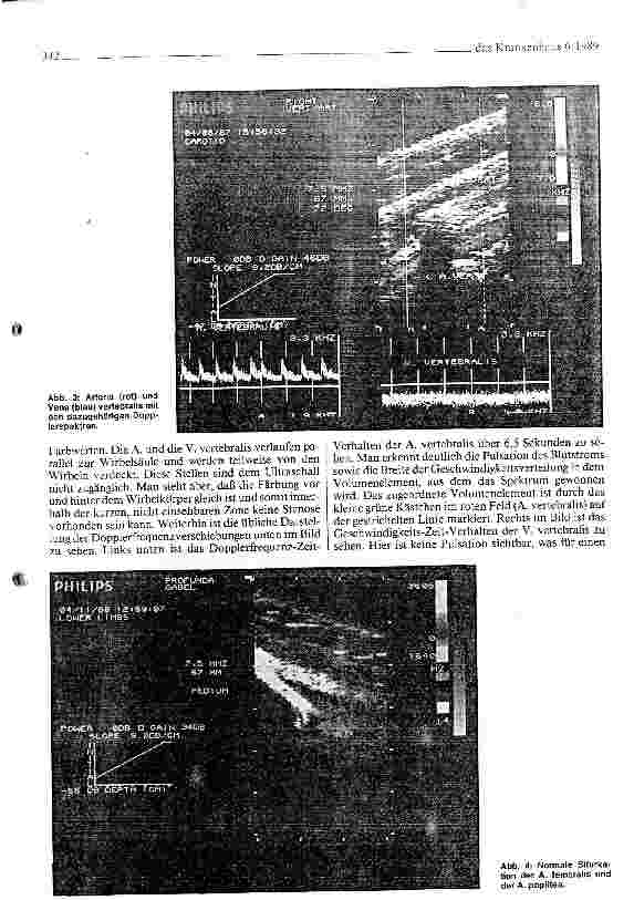 Vorschauseite 4: Methode und Technik der Angiodynographie