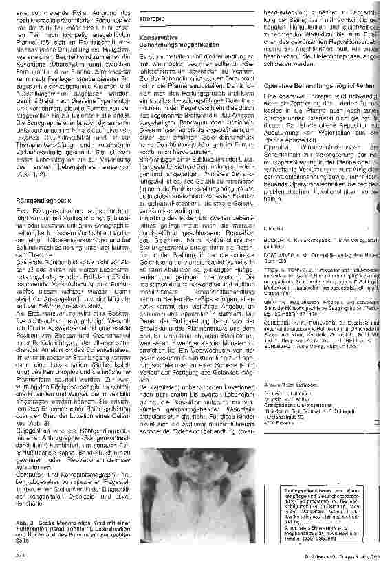 Vorschauseite 2: Angeborene Hüftdysplasie und Hüftluxation 1. Teil: Ätiologie, Diagnostik und Therapie