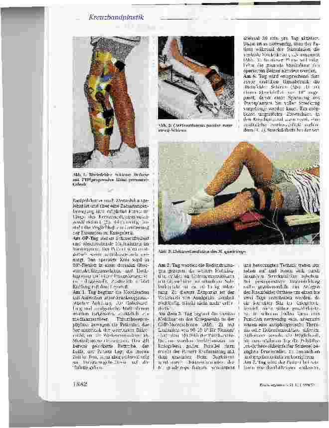 Vorschauseite 4: Rheinfelder Rehabilitation nach vorderer Kreuzbandplastik in Plantaris-bzw. Semitendinosussehnentechnikund Endobuttonfixation