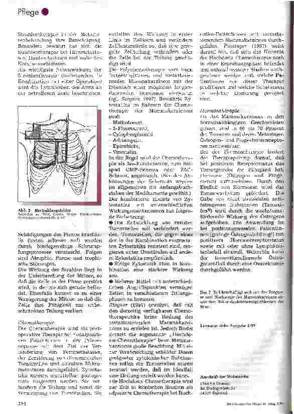 Vorschauseite 4: Das Mammakarzinom 2. Teil