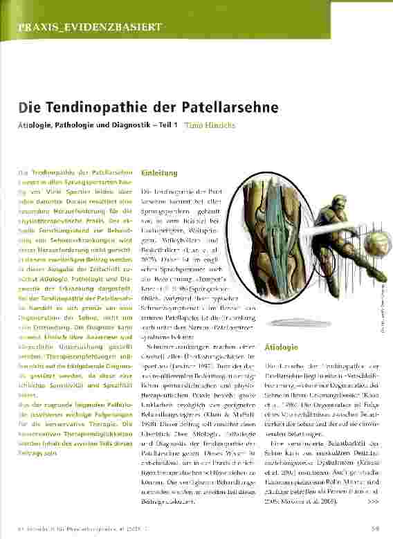 Vorschauseite 1: Die Tendinopathie der Patellarsehne