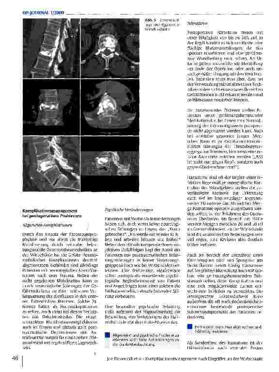 Vorschauseite 5: Komplikationsmanagement nach Eingriffen an der Wirbelsäule