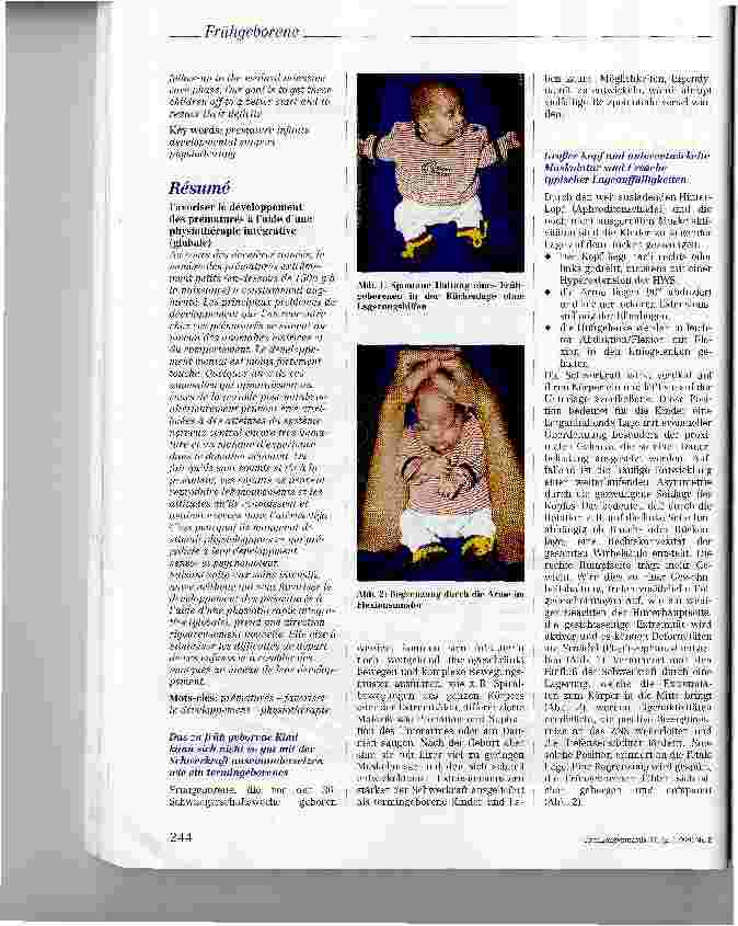 Vorschauseite 2: Physiotherapeutische integrative Entwicklungsförderung bei Frühgeborenen (PIEF)