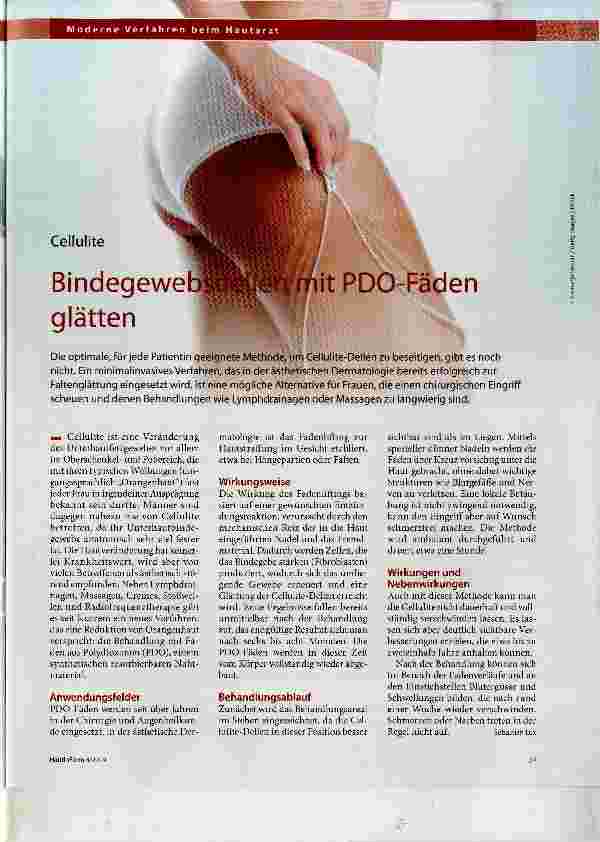 Vorschauseite 1: Bindegewebsdellen mit PDO-Fäden glätten