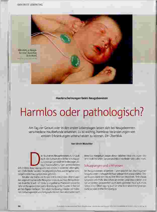 Vorschauseite 1: Harmlos oder pathologisch?