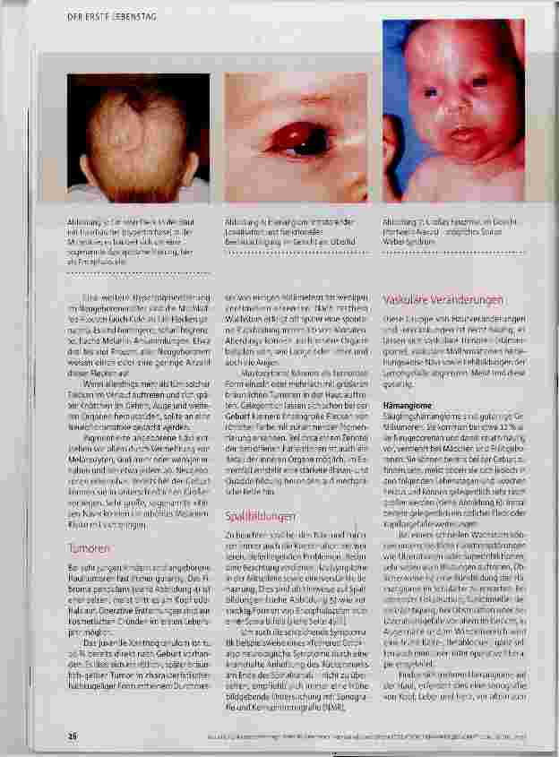 Vorschauseite 3: Harmlos oder pathologisch?