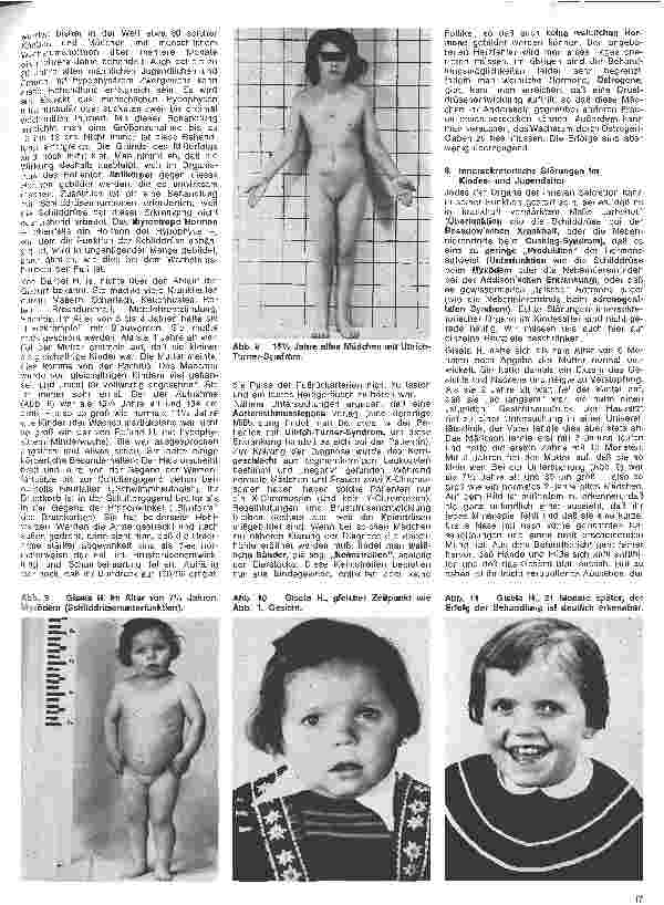 Vorschauseite 4: Kinderheilkunde 10. Folge: Normale u. gestörte Funktion des Wachstums und der inneren Sekretion