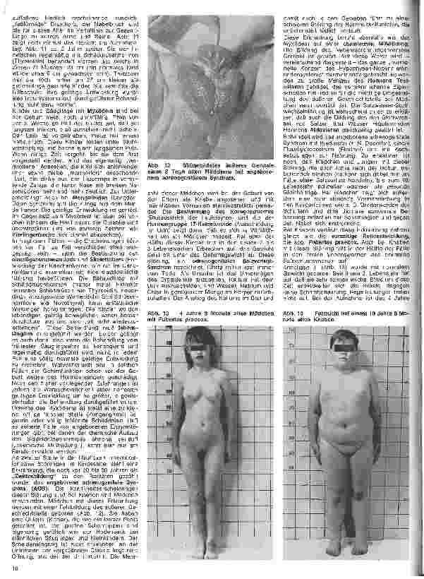Vorschauseite 5: Kinderheilkunde 10. Folge: Normale u. gestörte Funktion des Wachstums und der inneren Sekretion