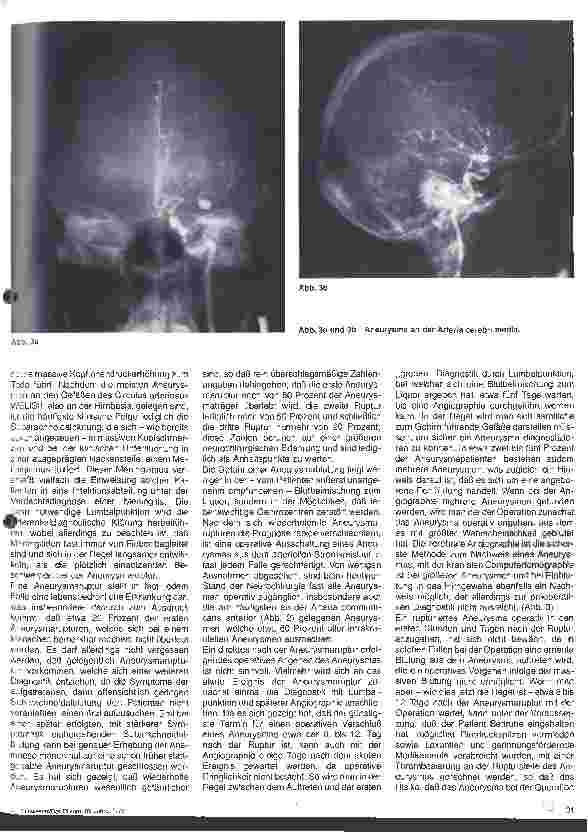 Vorschauseite 2: Themen aus der Neurochirurgie 17. folge Zerebrale Aneurysmen und Angiome
