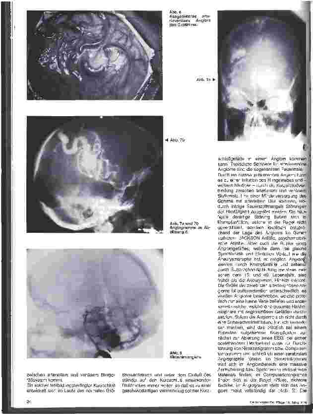 Vorschauseite 4: Themen aus der Neurochirurgie 17. folge Zerebrale Aneurysmen und Angiome