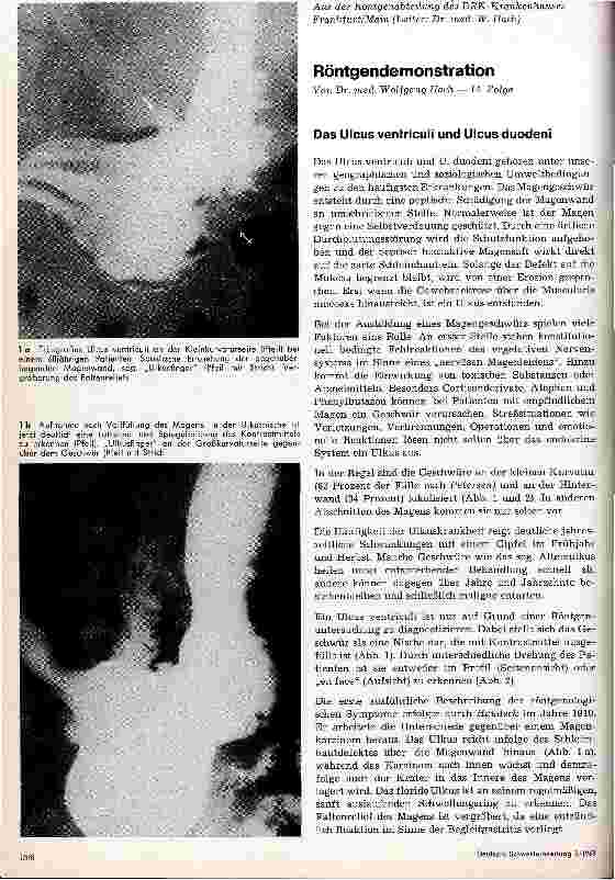 Vorschauseite 1: Röntgendemonstration Das Ulcus ventriculi und Ulcus duodeni