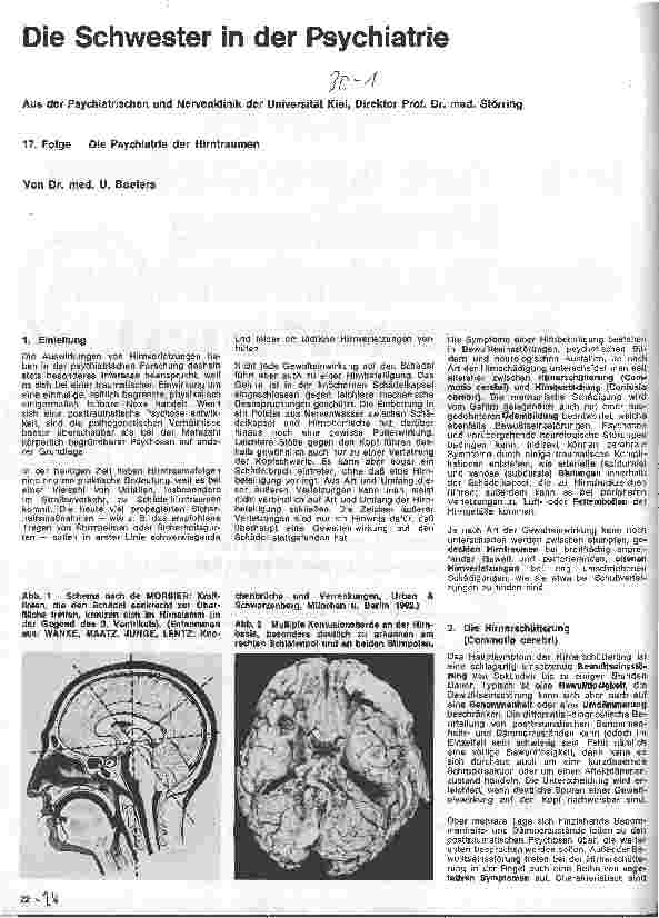 Vorschauseite 1: Die Schwester in der Psychiatrie 17. Folge: Die Psychiatrie der Hirntraumen