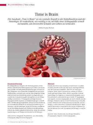 Vorschauseite 1: Time is Brain
