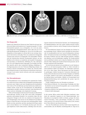 Vorschauseite 3: Time is Brain