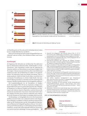 Vorschauseite 4: Time is Brain