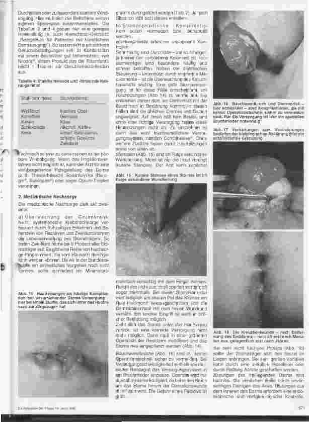 Vorschauseite 2: Stoma-Träger - Nachsorge 3. Folge (Schluß)