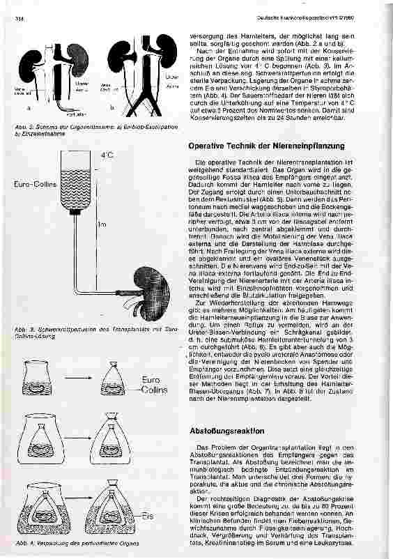 Vorschauseite 3: Aktuelle Probleme der Nierentransplantation