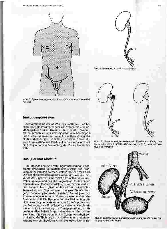 Vorschauseite 4: Aktuelle Probleme der Nierentransplantation