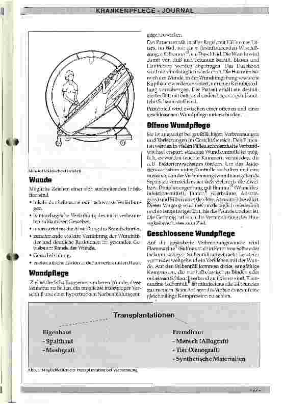Vorschauseite 6: Der Verbrennungspatient und seine Pflege