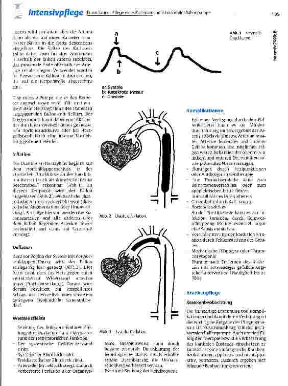Vorschauseite 2: Pflege eines Patienten mit intraaortaler Ballonpumpe