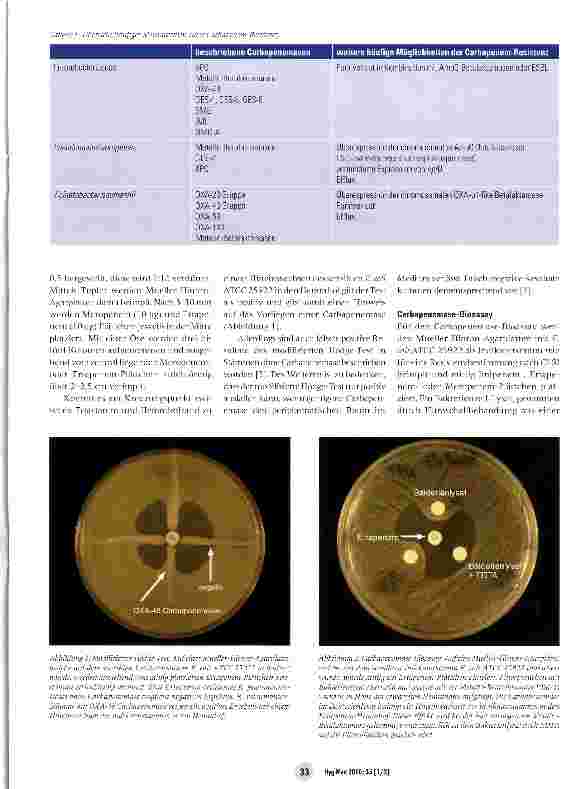 Vorschauseite 2: Carbapenemase-Detektion im mikrobiologischen Labor
