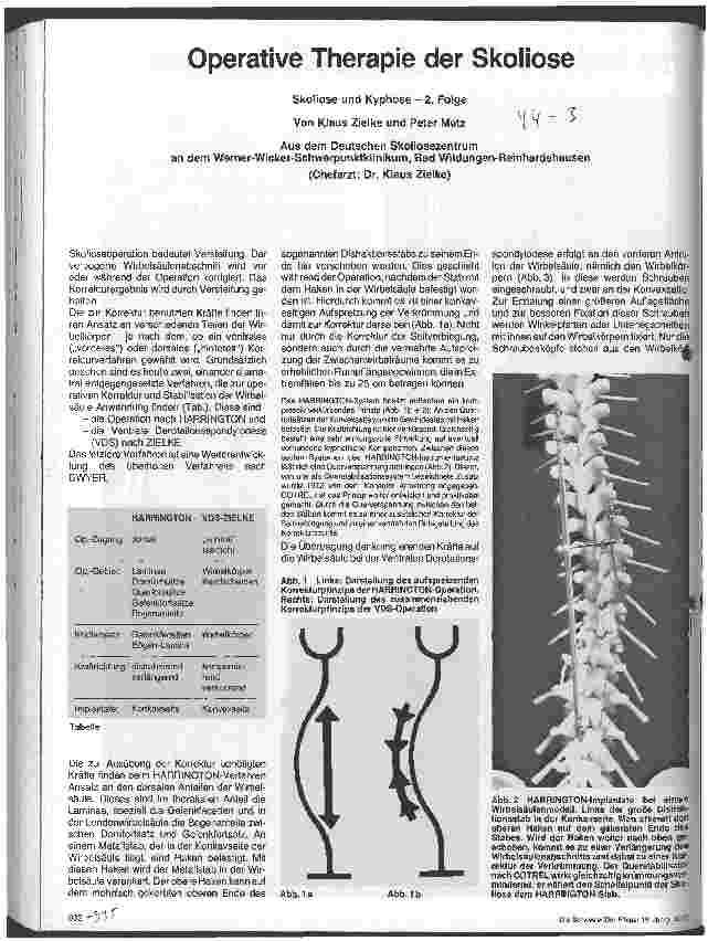 Vorschauseite 1: Operative Therapie der Skoliose Skoliose und Kyphose - 2. Folge