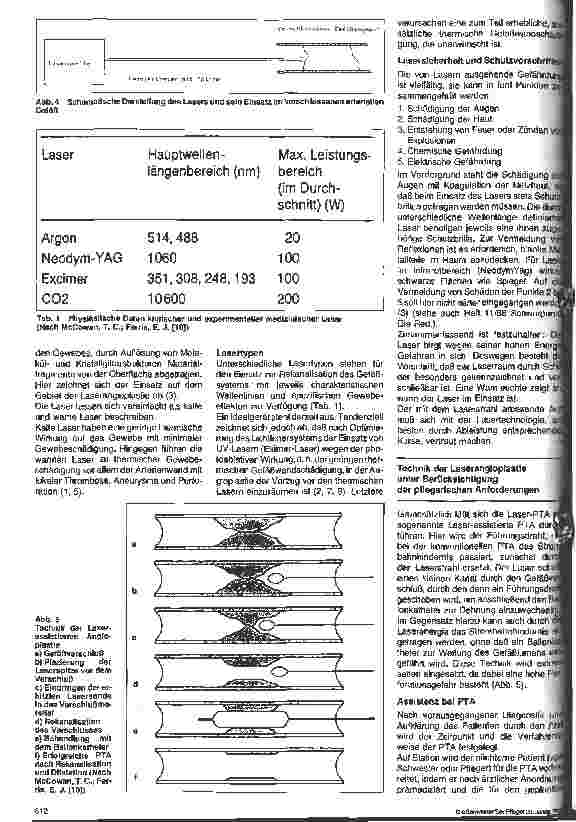 Vorschauseite 3: Einsatz von Lasern zur Behandlung von arteriosklerotischen Gefäßerkrankungen (Laserangioplastie)