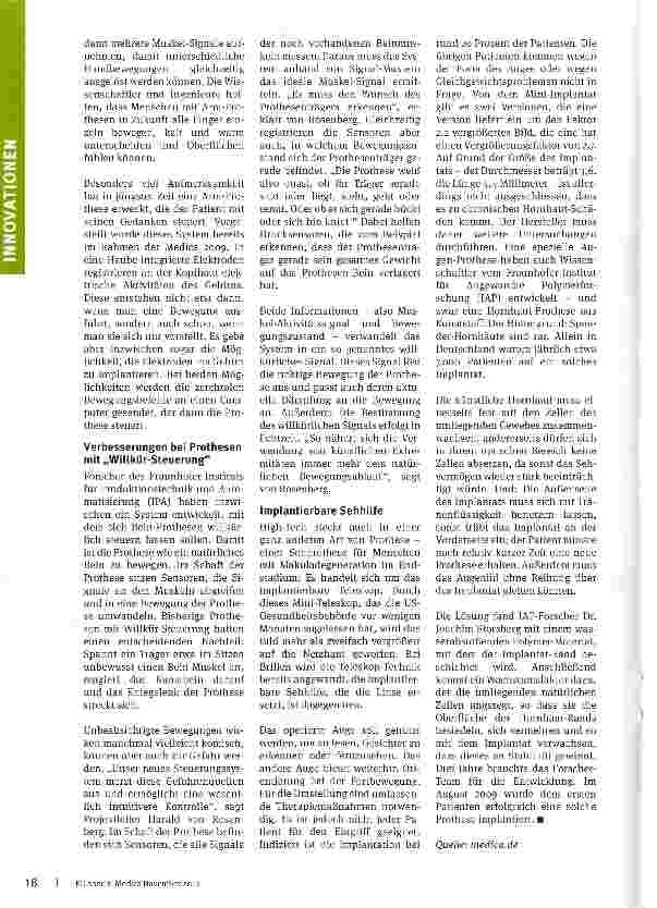 Vorschauseite 2: Konkurrenz für die Natur Das Spektrum für „intelligenten Organ-Ersatz wird immer größer