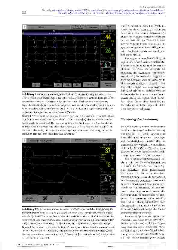 Vorschauseite 3: Neurally adjusted ventilatory assist (NAVA) -auf dem Weg zu einem physiologischeren Beatmungsverfahren?