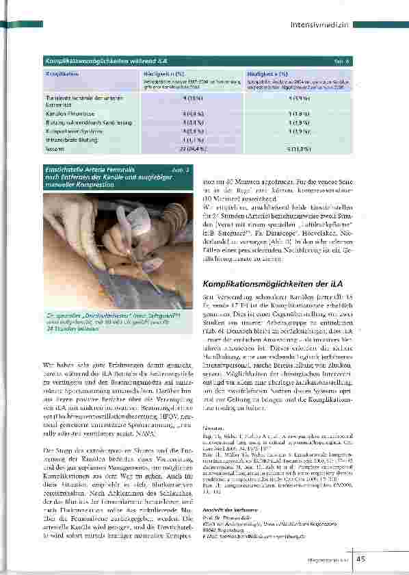 Vorschauseite 5: Der pumpenfreie Lungenersatz
