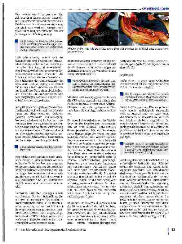 Vorschauseite 6: Management des Protheseninfekts