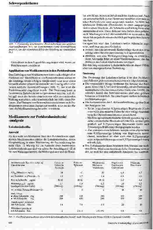 Vorschauseite 3: Periduralanästhesie