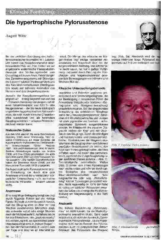 Vorschauseite 1: Die hypertrophische Pylorusstenose