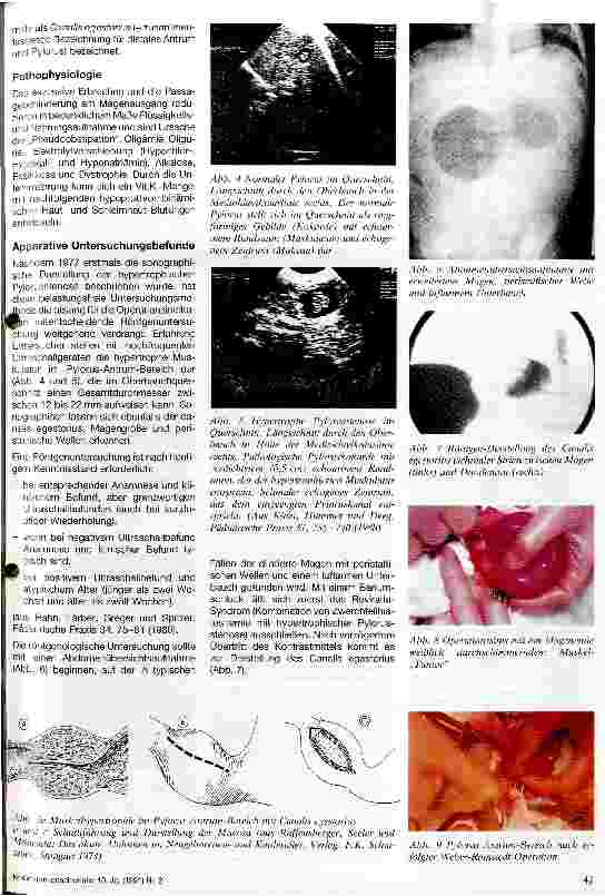 Vorschauseite 2: Die hypertrophische Pylorusstenose