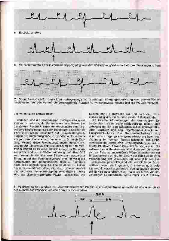 Vorschauseite 5: Herzrhythmusstörungen und ihre medikamentöse Therapie