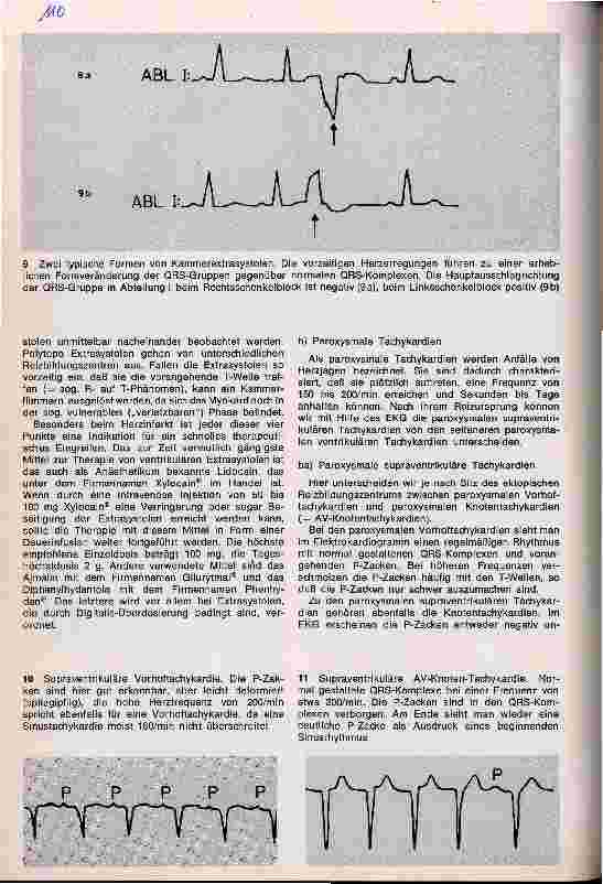 Vorschauseite 6: Herzrhythmusstörungen und ihre medikamentöse Therapie