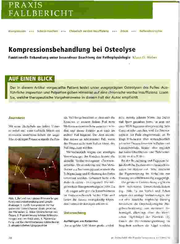 Vorschauseite 1: Kompressionsbehandlung bei Osteolyse