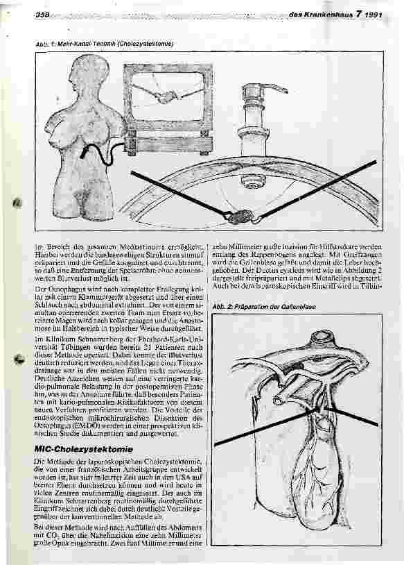 Vorschauseite 2: Die minimal invasive Chirurgie (MIC)